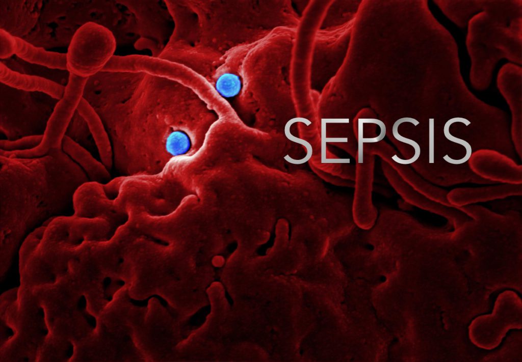 Sepsis Program